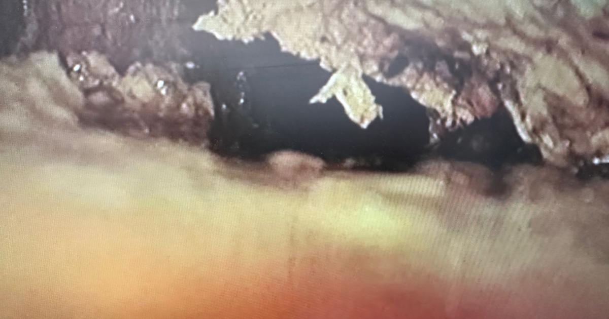 How to prevent sewer backups, blockages and potentially costly repairs